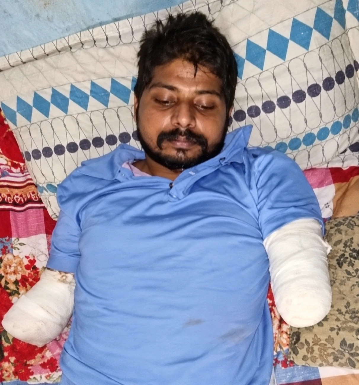 Sunil après son accident, en 2022.